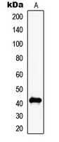 MAGEC2 / CT10 Antibody - Western blot analysis of MAGEC2 expression in NIH3T3 (A) whole cell lysates.