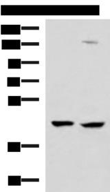 MAGEC2 / CT10 Antibody - Western blot analysis of 293T and Jurkat cell lysates  using MAGEC2 Polyclonal Antibody at dilution of 1:850
