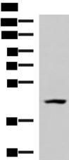 MAGEC2 / CT10 Antibody - Western blot analysis of 293T cell lysate  using MAGEC2 Polyclonal Antibody at dilution of 1:700