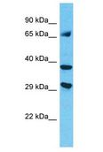 MAGEC3 Antibody - MAGEC3 antibody Western Blot of HepG2. Antibody dilution: 1 ug/ml.  This image was taken for the unconjugated form of this product. Other forms have not been tested.
