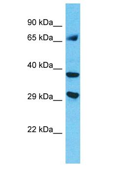 MAGEC3 Antibody - MAGEC3 antibody Western Blot of HepG2. Antibody dilution: 1 ug/ml.  This image was taken for the unconjugated form of this product. Other forms have not been tested.