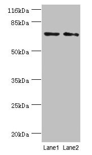 MAGEC3 Antibody - Western blot All lanes: MAGEC3 antibody at 2µg/ml Lane 1: A375 cells Lane 2: Rat thymus tissue Secondary Goat polyclonal to rabbit IgG at 1/10000 dilution Predicted band size: 72, 39 kDa Observed band size: 72 kDa