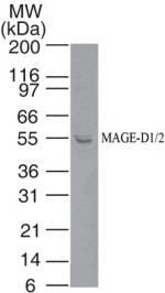MAGED1/2 Antibody - Western blot of MAGE-D1/2 in A375 cell lysate using Polyclonal Antibody to MAGE-D1/2 at 5 ug/ml. Goat anti-rabbit Ig HRP secondary antibody, and PicoTect ECL substrate solution, were used for this test.