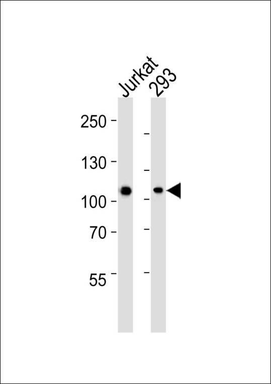 MAGED1 / NRAGE Antibody - Western blot of lysates from Jurkat, 293 cell line (from left to right) with MAGED1 Antibody. Antibody was diluted at 1:1000 at each lane. A goat anti-mouse IgG H&L (HRP) at 1:3000 dilution was used as the secondary antibody. Lysates at 35 ug per lane.