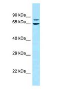 MAGED1 / NRAGE Antibody - MAGED1 / NRAGE antibody Western Blot of Jurkat.  This image was taken for the unconjugated form of this product. Other forms have not been tested.