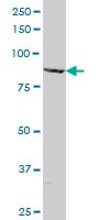 MAGED1 / NRAGE Antibody - MAGED1 monoclonal antibody (M06), clone 1E1. Western blot of MAGED1 expression in Jurkat.