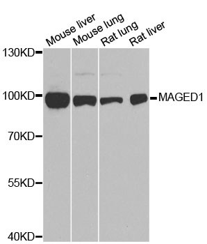MAGED1 / NRAGE Antibody - Western blot analysis of extracts of various cell lines, using MAGED1 antibody at 1:1000 dilution. The secondary antibody used was an HRP Goat Anti-Rabbit IgG (H+L) at 1:10000 dilution. Lysates were loaded 25ug per lane and 3% nonfat dry milk in TBST was used for blocking. An ECL Kit was used for detection and the exposure time was 90s.