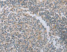 MAGED1 / NRAGE Antibody - Immunohistochemistry of paraffin-embedded Human tonsil using MAGED1 Polyclonal Antibody at dilution of 1:30.