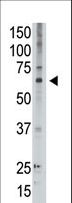 MAGED2 Antibody - The anti-MAGED2 C-term Antibody is used in Western blot to detect MAGED2 in A549 lysate.