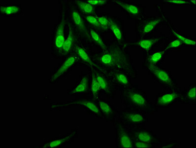 MAGED2 Antibody - Immunofluorescence staining of Hela cells with MAGED2 Antibody at 1:145, counter-stained with DAPI. The cells were fixed in 4% formaldehyde, permeabilized using 0.2% Triton X-100 and blocked in 10% normal Goat Serum. The cells were then incubated with the antibody overnight at 4°C. The secondary antibody was Alexa Fluor 488-congugated AffiniPure Goat Anti-Rabbit IgG(H+L).