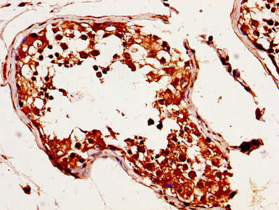 MAGED2 Antibody - IHC image of MAGED2 Antibody diluted at 1:320 and staining in paraffin-embedded human testis tissue performed on a Leica BondTM system. After dewaxing and hydration, antigen retrieval was mediated by high pressure in a citrate buffer (pH 6.0). Section was blocked with 10% normal goat serum 30min at RT. Then primary antibody (1% BSA) was incubated at 4°C overnight. The primary is detected by a biotinylated secondary antibody and visualized using an HRP conjugated SP system.
