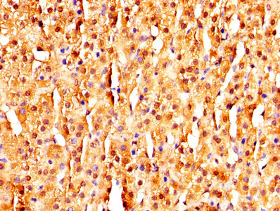 MAGED2 Antibody - IHC image of MAGED2 Antibody diluted at 1:320 and staining in paraffin-embedded human adrenal gland tissue performed on a Leica BondTM system. After dewaxing and hydration, antigen retrieval was mediated by high pressure in a citrate buffer (pH 6.0). Section was blocked with 10% normal goat serum 30min at RT. Then primary antibody (1% BSA) was incubated at 4°C overnight. The primary is detected by a biotinylated secondary antibody and visualized using an HRP conjugated SP system.