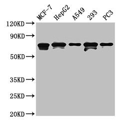 MAGED2 Antibody - Western Blot Positive WB detected in: MCF-7 whole cell lysate, HepG2 whole cell lysate, A549 whole cell lysate, 293 whole cell lysate, PC-3 whole cell lysate All lanes: MAGED2 antibody at 4.5µg/ml Secondary Goat polyclonal to rabbit IgG at 1/50000 dilution Predicted band size: 65, 64 kDa Observed band size: 65, 64 kDa