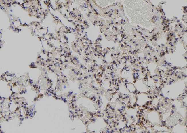 MAGED2 Antibody - 1:100 staining rat lung tissue by IHC-P. The sample was formaldehyde fixed and a heat mediated antigen retrieval step in citrate buffer was performed. The sample was then blocked and incubated with the antibody for 1.5 hours at 22°C. An HRP conjugated goat anti-rabbit antibody was used as the secondary.