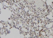 MAGED2 Antibody - 1:100 staining rat lung tissue by IHC-P. The sample was formaldehyde fixed and a heat mediated antigen retrieval step in citrate buffer was performed. The sample was then blocked and incubated with the antibody for 1.5 hours at 22°C. An HRP conjugated goat anti-rabbit antibody was used as the secondary.
