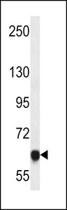 MAGED4 Antibody - MAGED4B Antibody western blot of HepG2 cell line lysates (35 ug/lane). The MAGED4B antibody detected the MAGED4B protein (arrow).