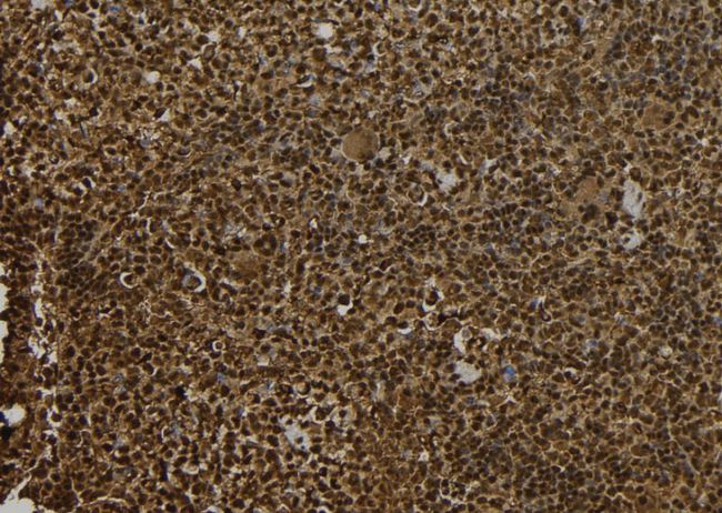 MAGEE1 Antibody - 1:100 staining mouse spleen tissue by IHC-P. The sample was formaldehyde fixed and a heat mediated antigen retrieval step in citrate buffer was performed. The sample was then blocked and incubated with the antibody for 1.5 hours at 22°C. An HRP conjugated goat anti-rabbit antibody was used as the secondary.