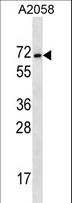 MAGEE2 Antibody - MAGEE2 Antibody western blot of A2058 cell line lysates (35 ug/lane). The MAGEE2 antibody detected the MAGEE2 protein (arrow).