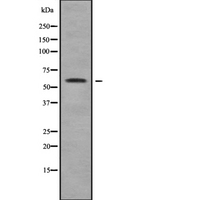 MAGEE2 Antibody - Western blot analysis of MAGE2 using COLO205 whole cells lysates