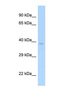 MAGEF1 Antibody - MAGEF1 antibody Western blot of H226 Cell lysate. Antibody concentration 1 ug/ml.  This image was taken for the unconjugated form of this product. Other forms have not been tested.