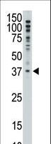 MAGEF1 Antibody - The anti-MAGEF1 C-term Antibody is used in Western blot to detect MAGEF1 in A375 lysate.