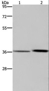 MAGEF1 Antibody - Western blot analysis of A549 cell and human fetal liver tissue, using MAGEF1 Polyclonal Antibody at dilution of 1:300.
