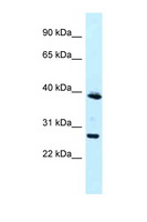 MAGEF1 Antibody - MAGEF1 antibody Western blot of Jurkat Cell lysate. Antibody concentration 1 ug/ml.  This image was taken for the unconjugated form of this product. Other forms have not been tested.