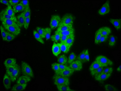 MAGI1 Antibody - Immunofluorescence staining of HepG2 cells diluted at 1:133, counter-stained with DAPI. The cells were fixed in 4% formaldehyde, permeabilized using 0.2% Triton X-100 and blocked in 10% normal Goat Serum. The cells were then incubated with the antibody overnight at 4°C.The Secondary antibody was Alexa Fluor 488-congugated AffiniPure Goat Anti-Rabbit IgG (H+L).