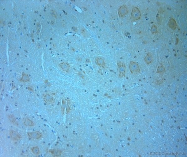 MAGI2 / AIP-1 Antibody - Rabbit antibody to AIP1 (1050-1100). IHC-P on paraffin sections of rat spinal cord tissue. The animal was perfused using Autoperfuser at a pressure of 110 mm Hg with 300 ml 4% FA and further post fixed overnight before being processed for paraffin embedding. HIER: Tris-EDTA, pH 9 for 20 min using Thermo PT Module. Blocking: 0.2% LFDM in TBST filtered through a 0.2 micron filter. Detection was done using Novolink HRP polymer from Leica following manufacturers instructions. Primary antibody: dilution 1:1000, incubated 30 min at RT (using Autostainer). Sections were counterstained with Harris Hematoxylin.