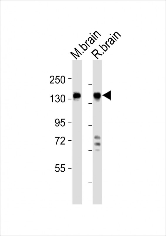 MAGI2 / AIP-1 Antibody - All lanes : Anti-MAGI2 Antibody at 1:2000 dilution Lane 1: mouse brain lysates Lane 2: rat brain lysates Lysates/proteins at 20 ug per lane. Secondary Goat Anti-Rabbit IgG, (H+L), Peroxidase conjugated at 1/10000 dilution Predicted band size : 159 kDa Blocking/Dilution buffer: 5% NFDM/TBST.