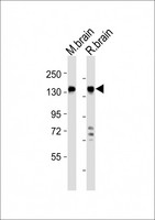 MAGI2 / AIP-1 Antibody - All lanes : Anti-MAGI2 Antibody at 1:2000 dilution Lane 1: mouse brain lysates Lane 2: rat brain lysates Lysates/proteins at 20 ug per lane. Secondary Goat Anti-Rabbit IgG, (H+L), Peroxidase conjugated at 1/10000 dilution Predicted band size : 159 kDa Blocking/Dilution buffer: 5% NFDM/TBST.