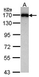 MAGI2 / AIP-1 Antibody - Sample (30 ug of whole cell lysate). A: Raji. 7.5% SDS PAGE. MAGI-2 antibody. MAGI2 antibody diluted at 1:1000.
