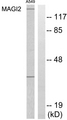MAGI2 / AIP-1 Antibody - Western blot analysis of lysates from A549 cells, using MAGI2 Antibody. The lane on the right is blocked with the synthesized peptide.