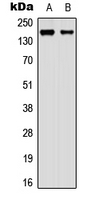 MAGI2 / AIP-1 Antibody - Western blot analysis of AIP-1 expression in Raji (A); A549 (B) whole cell lysates.