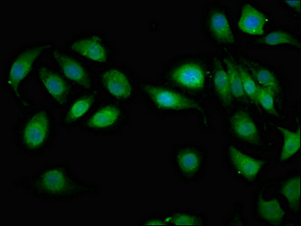MAGI2 / AIP-1 Antibody - Immunofluorescent analysis of A549 cells at a dilution of 1:100 and Alexa Fluor 488-congugated AffiniPure Goat Anti-Rabbit IgG(H+L)