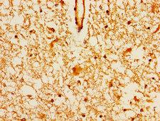 MAGI2 / AIP-1 Antibody - Immunohistochemistry image of paraffin-embedded human brain tissue at a dilution of 1:100