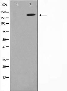 MAGI2 / AIP-1 Antibody - Western blot analysis on A549 cell lysates using MAGI2 antibody. The lane on the left is treated with the antigen-specific peptide.