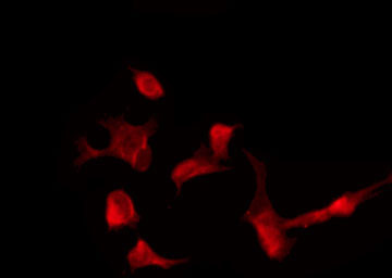 MAGI2 / AIP-1 Antibody - Staining A549 cells by IF/ICC. The samples were fixed with PFA and permeabilized in 0.1% Triton X-100, then blocked in 10% serum for 45 min at 25°C. The primary antibody was diluted at 1:200 and incubated with the sample for 1 hour at 37°C. An Alexa Fluor 594 conjugated goat anti-rabbit IgG (H+L) Ab, diluted at 1/600, was used as the secondary antibody.