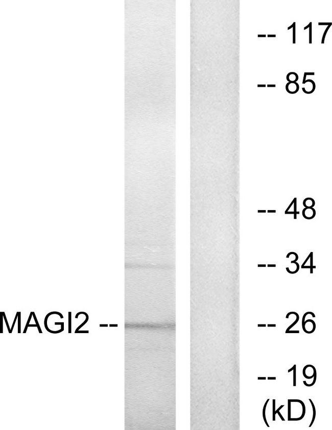 MAGI2 / AIP-1 Antibody - Western blot analysis of extracts from HT-29 cells, using MAGI2 antibody.