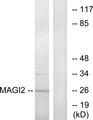 MAGI2 / AIP-1 Antibody - Western blot analysis of extracts from HT-29 cells, using MAGI2 antibody.