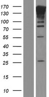 MAGI2 / AIP-1 Protein - Western validation with an anti-DDK antibody * L: Control HEK293 lysate R: Over-expression lysate