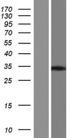 MAGIX Protein - Western validation with an anti-DDK antibody * L: Control HEK293 lysate R: Over-expression lysate
