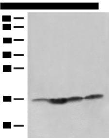 MAGOHB / Mago Antibody - Western blot analysis of Human prostate tissue Jurkat cell Hela and HL-60 cell lysates  using MAGOHB Polyclonal Antibody at dilution of 1:400