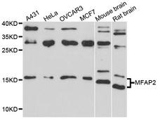 MAGP / MFAP2 Antibody - Western blot analysis of extract of various cells.