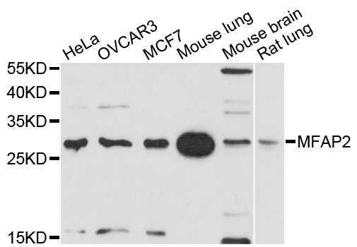 MAGP / MFAP2 Antibody - Western blot analysis of extracts of various cell lines, using MFAP2 antibody at 1:1000 dilution. The secondary antibody used was an HRP Goat Anti-Rabbit IgG (H+L) at 1:10000 dilution. Lysates were loaded 25ug per lane and 3% nonfat dry milk in TBST was used for blocking. An ECL Kit was used for detection and the exposure time was 30s.