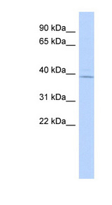 MAGT1 Antibody - MAGT1 antibody Western blot of Fetal Brain lysate. This image was taken for the unconjugated form of this product. Other forms have not been tested.