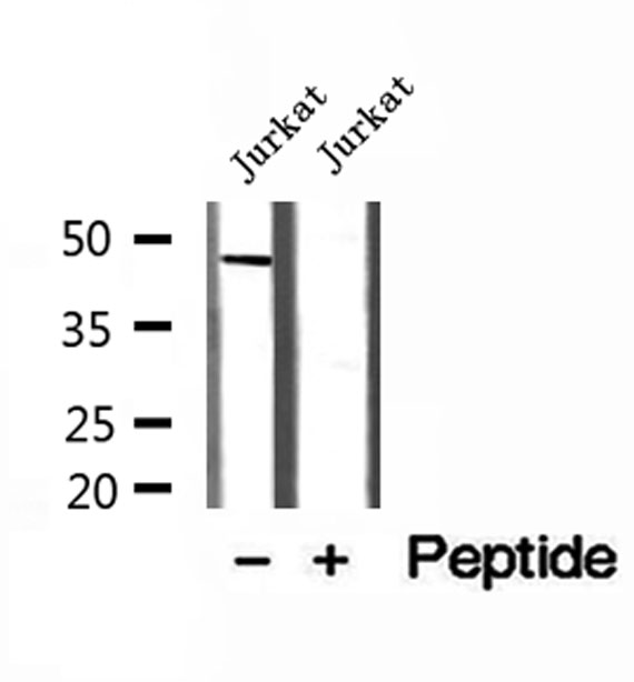 MAGT1 Antibody - Western blot analysis of extracts of Jurkat cells using MAGT1 antibody.