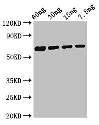 Major Allergen Bla g 1.0101 Antibody - Western Blot Positive WB detected in Recombinant protein All lanes: Major allergen Bla g 1.0101 antibody at 2.8µg/ml Secondary Goat polyclonal to rabbit IgG at 1/50000 dilution Predicted band size: 62 kDa Observed band size: 62 kDa