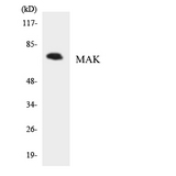 MAK Antibody - Western blot analysis of the lysates from HepG2 cells using MAK antibody.
