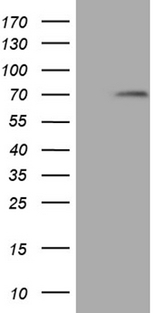 MAK Antibody - HEK293T cells were transfected with the pCMV6-ENTRY control. (Left lane) or pCMV6-ENTRY MAK. (Right lane) cDNA for 48 hrs and lysed. Equivalent amounts of cell lysates. (5 ug per lane) were separated by SDS-PAGE and immunoblotted with anti-MAK. (1:2000)